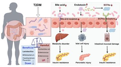 The potential mechanism of action of gut flora and bile acids through the TGR5/TRPV1 signaling pathway in diabetic peripheral neuropathic pain